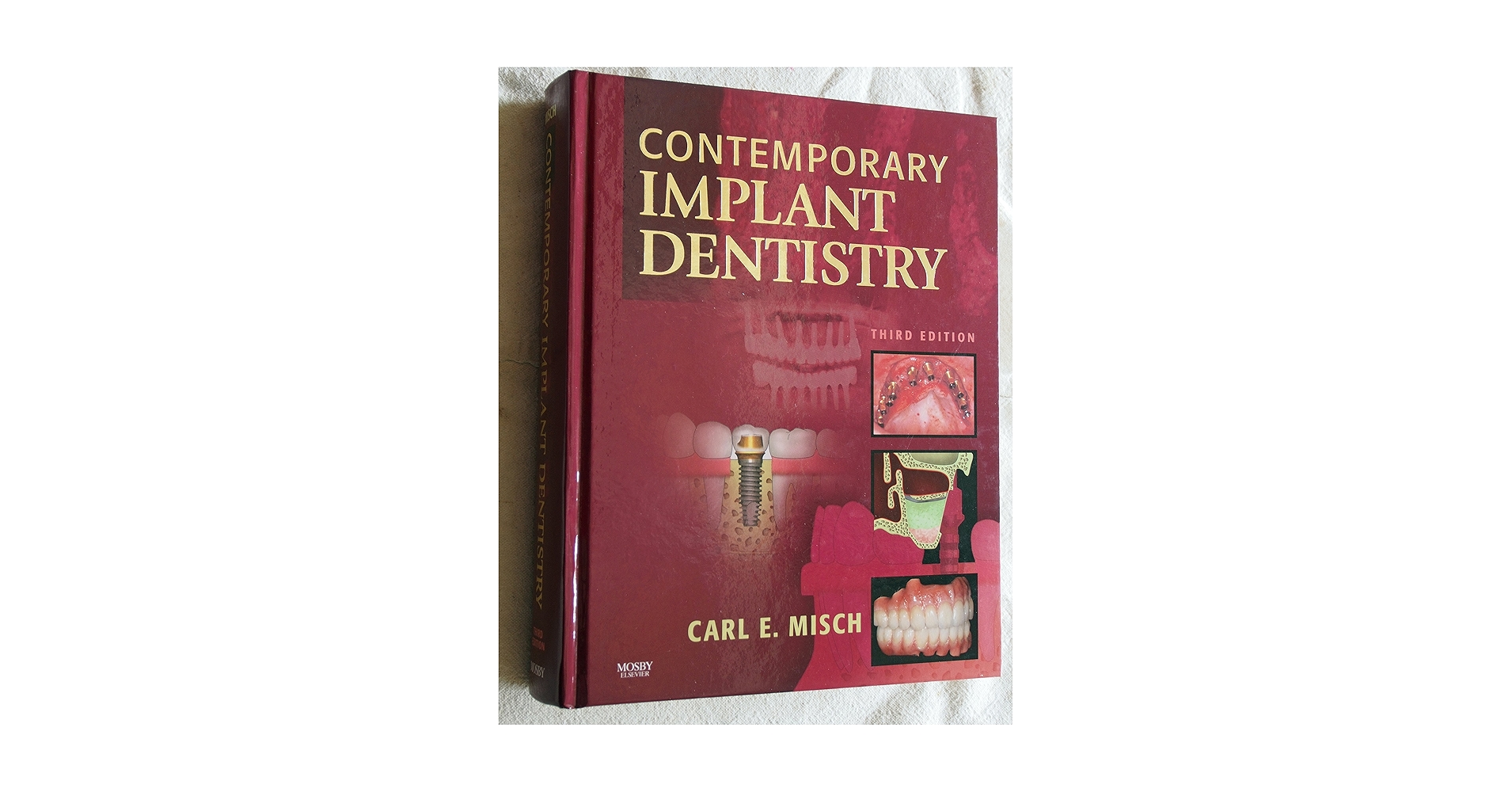 Amazon.com: Contemporary Implant Dentistry: 9780323043731: Misch